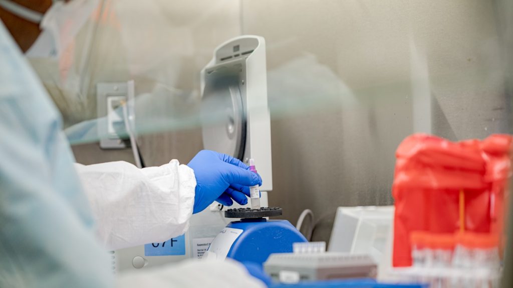 State Public Health Laboratory in Exton Tests for COVID 19 49628500537