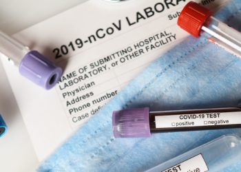 واکنش ایمنی بدن در برابر کرونا ضعیف‌تر از آنفولانزا است