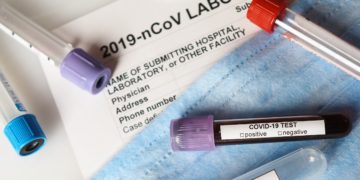 واکنش ایمنی بدن در برابر کرونا ضعیف‌تر از آنفولانزا است