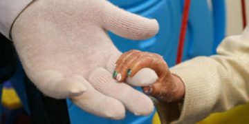 خطر جدی در کمین جان بیماران پروانه‌ای ایران: پنج تن پانسمان بیماران پروانه‌ای در ایران ناپدید شده است