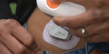 دستگاه بررسی لحظه‌ای قند خون در بریتیش کلمبیا تحت پوشش بیمه درمانی قرار گرفت