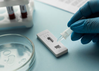 جواب تست‌های تشخیص سریع کرونا چندان قابل اعتماد نیست