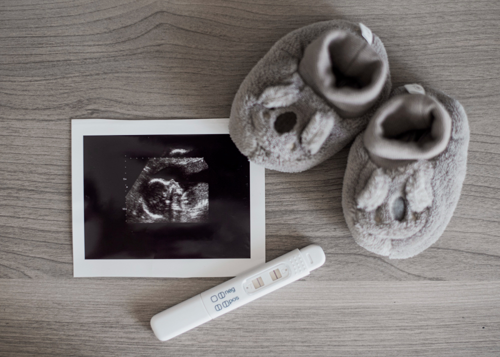 cute little shoes x ray photo