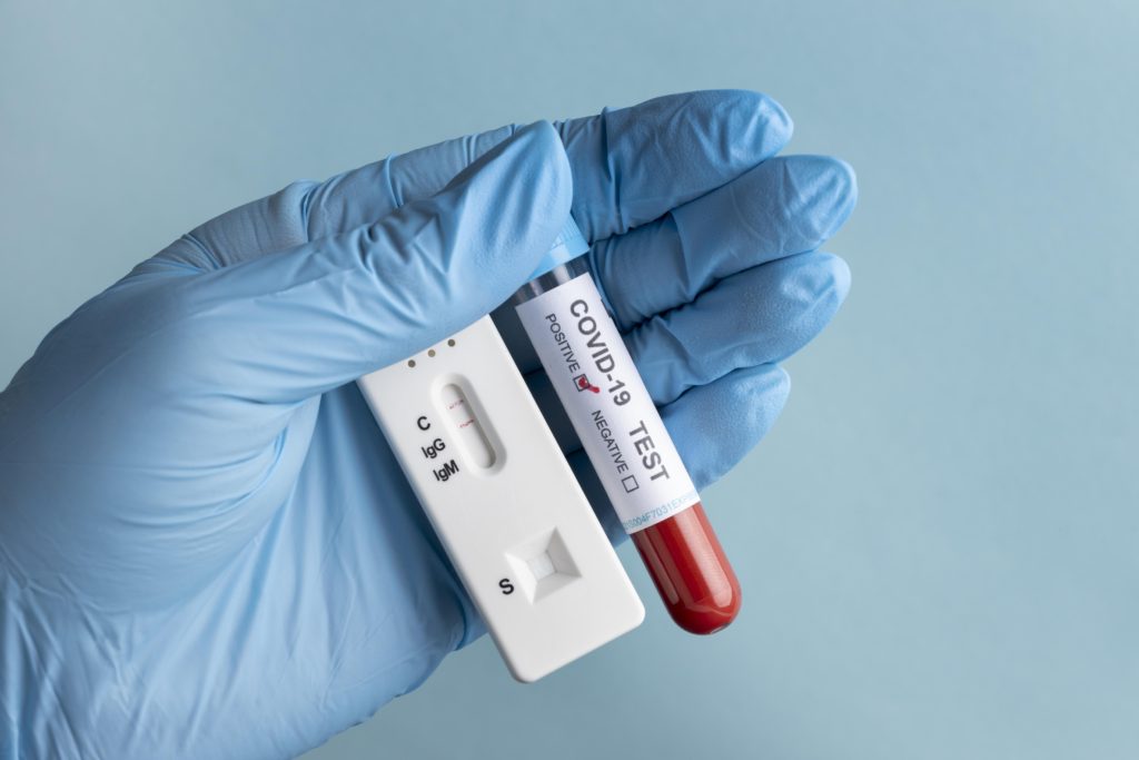 hand with protective gloves holding blood sample covid test